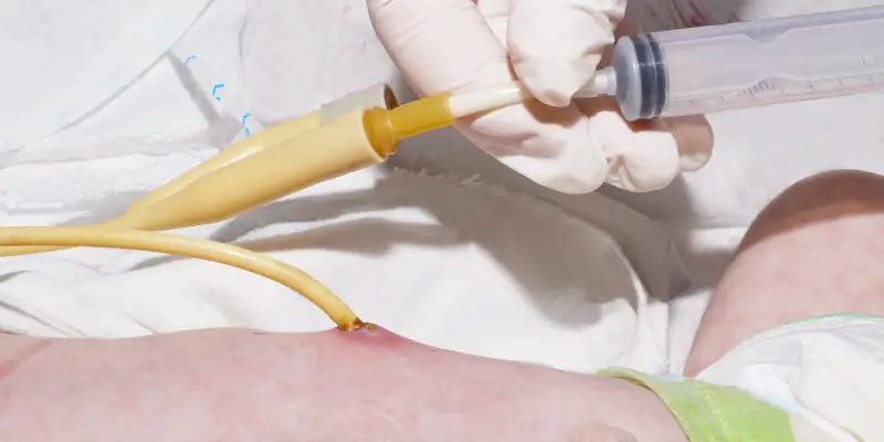 Gastrostomia: indicações, complicações e cuidados da enfermagem