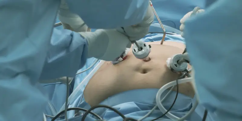 cuidado após cirurgia bariátrica