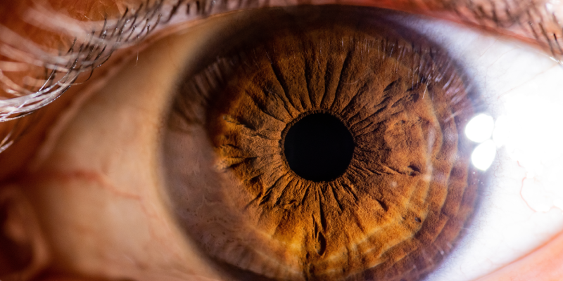 Anisocoria: mecanismos, causas e investigação