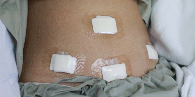 Cirurgias bariátricas: cuidados pela enfermagem no pós-operatório