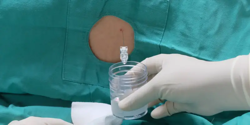 Meningite em crianças: quadro clínico, diagnóstico e tratamento 