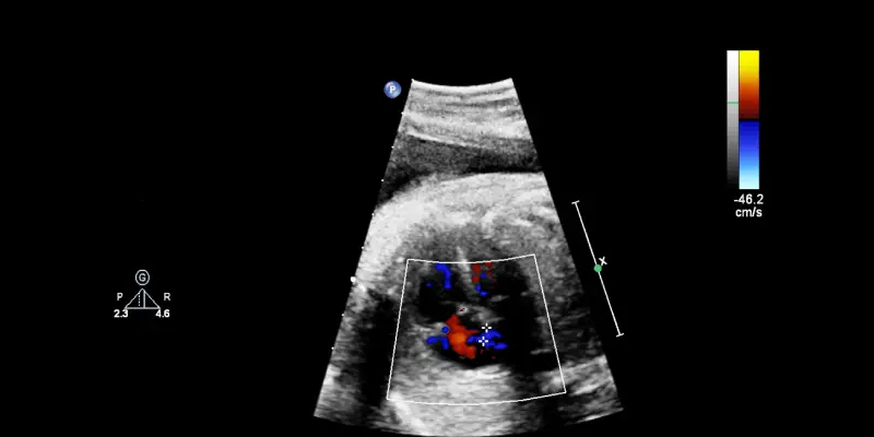 Cardiopatia congênita no período neonatal