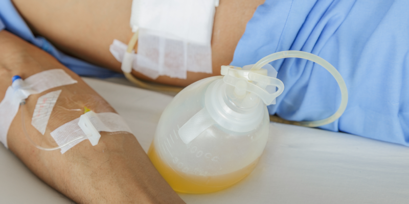 Tipos de drenos cirúrgicos e cuidados da enfermagem