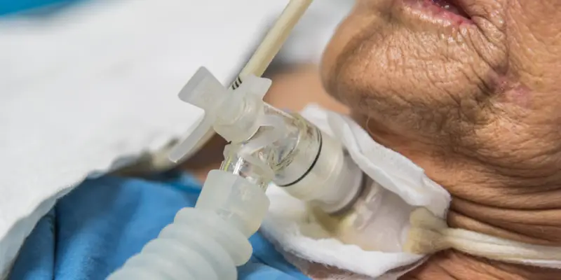 Paciente traqueostomizado: cuidados e orientações para enfermagem